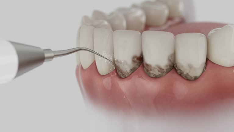 Reliable Dental Implants contractor in Inverness, FL by Smile Center Dentistry